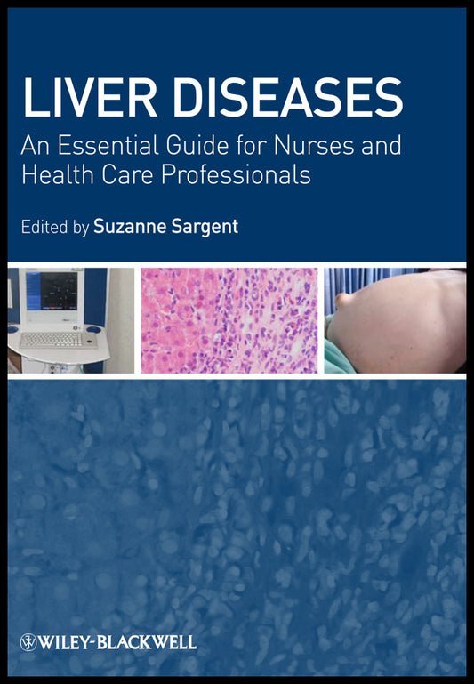 Liver Diseases; An Essential Guide for Nurses and Health Care Professionals (Paperback / softback) 9781405163064