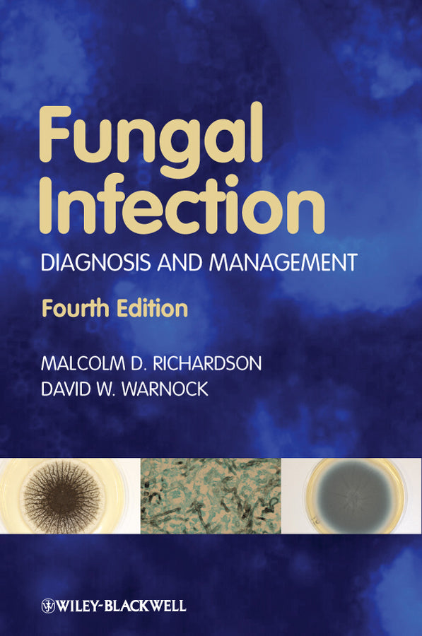 Fungal Infection; Diagnosis and Management (Paperback / softback) 9781405170567
