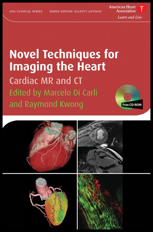 Novel Techniques for Imaging the Heart; Cardiac MR and CT (Hardback) 9781405175333