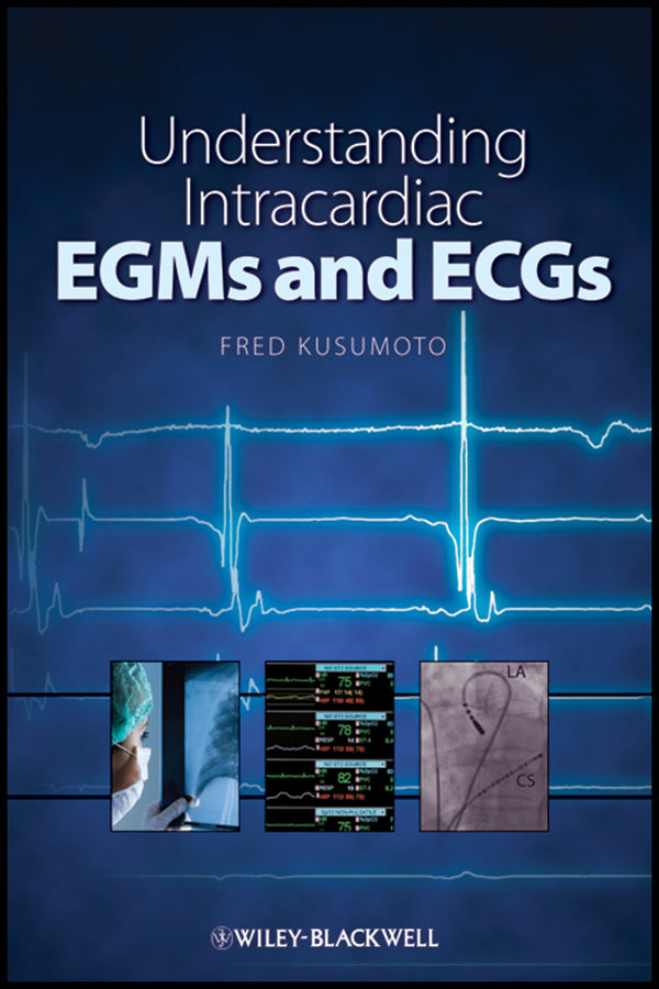 Understanding Intracardiac EGMs and ECGs (Paperback / softback) 9781405184106