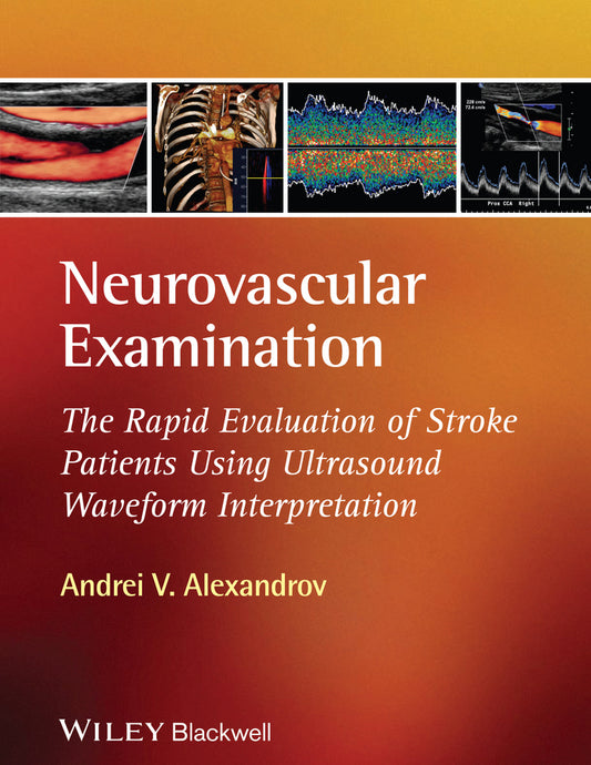 Neurovascular Examination; The Rapid Evaluation of Stroke Patients Using Ultrasound Waveform Interpretation (Hardback) 9781405185301