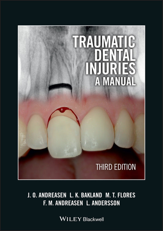 Traumatic Dental Injuries; A Manual (Paperback / softback) 9781405190619