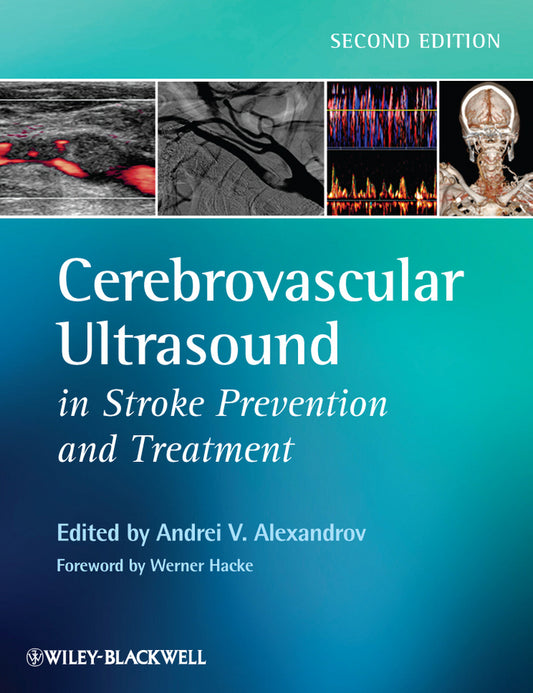 Cerebrovascular Ultrasound in Stroke Prevention and Treatment (Hardback) 9781405195768