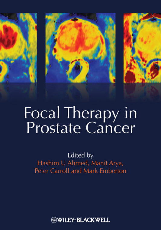 Focal Therapy in Prostate Cancer (Hardback) 9781405196499