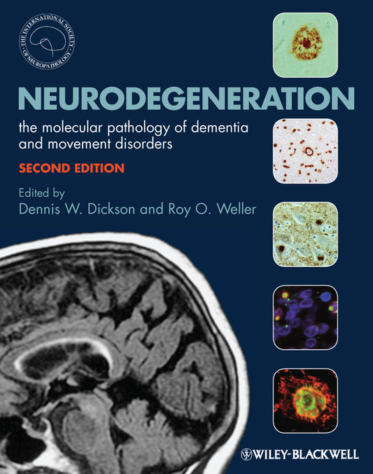 Neurodegeneration; The Molecular Pathology of Dementia and Movement Disorders (Hardback) 9781405196932