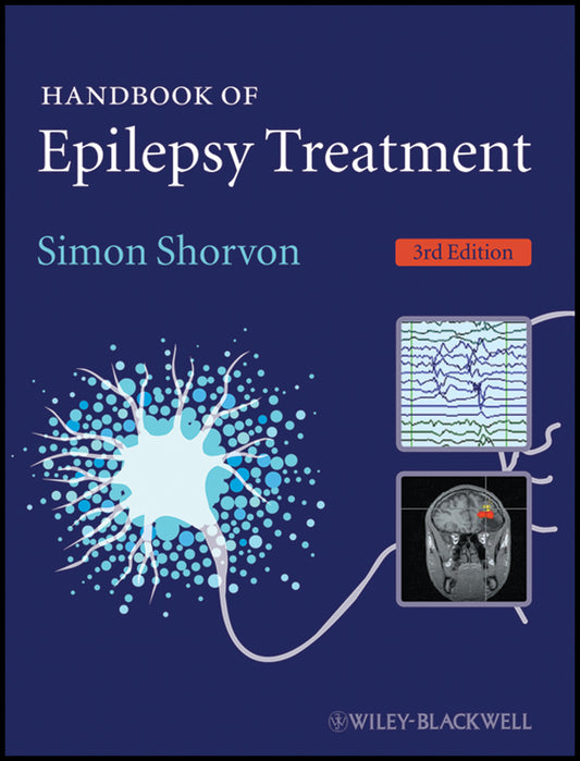 Handbook of Epilepsy Treatment (Paperback / softback) 9781405198189