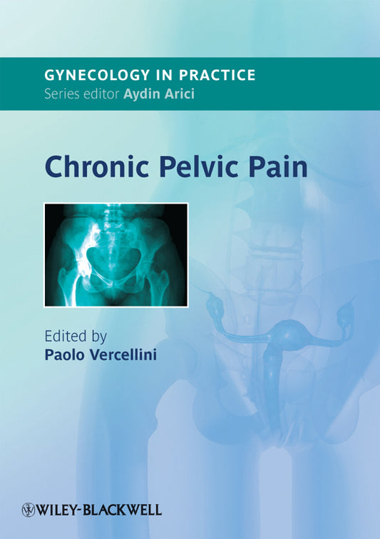 Chronic Pelvic Pain (Paperback / softback) 9781444330663