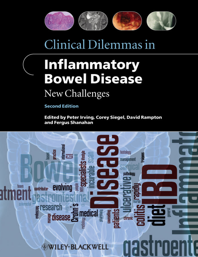 Clinical Dilemmas in Inflammatory Bowel Disease; New Challenges (Paperback / softback) 9781444334548