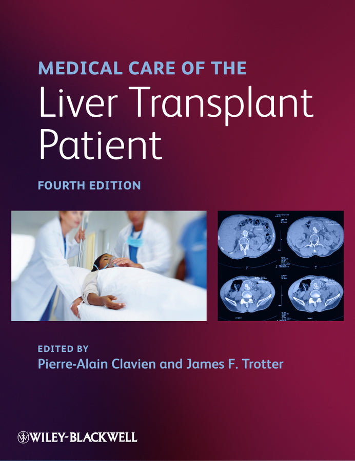 Medical Care of the Liver Transplant Patient (Hardback) 9781444335910