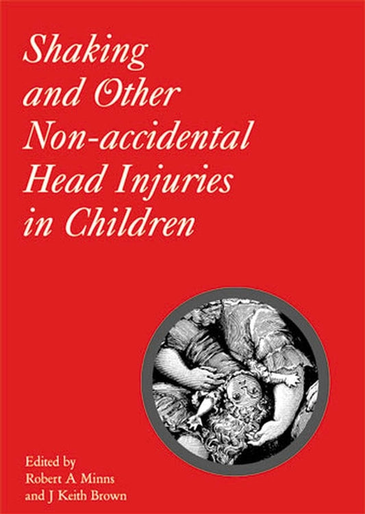 Shaking and Other Non-Accidental Head Injuries in Children (Hardback) 9781898683353