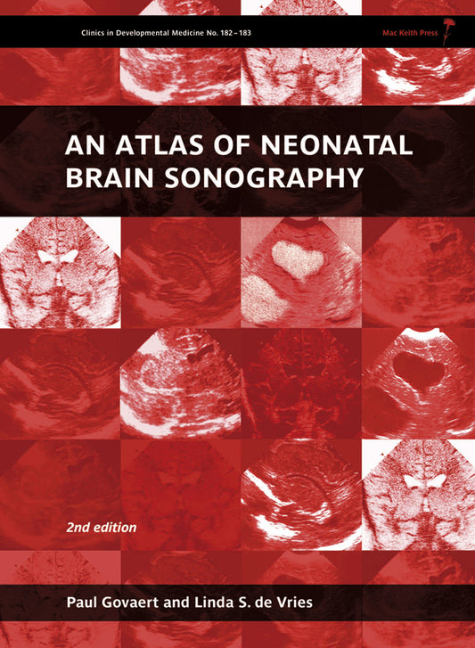 An Atlas of Neonatal Brain Sonography (Hardback) 9781898683568