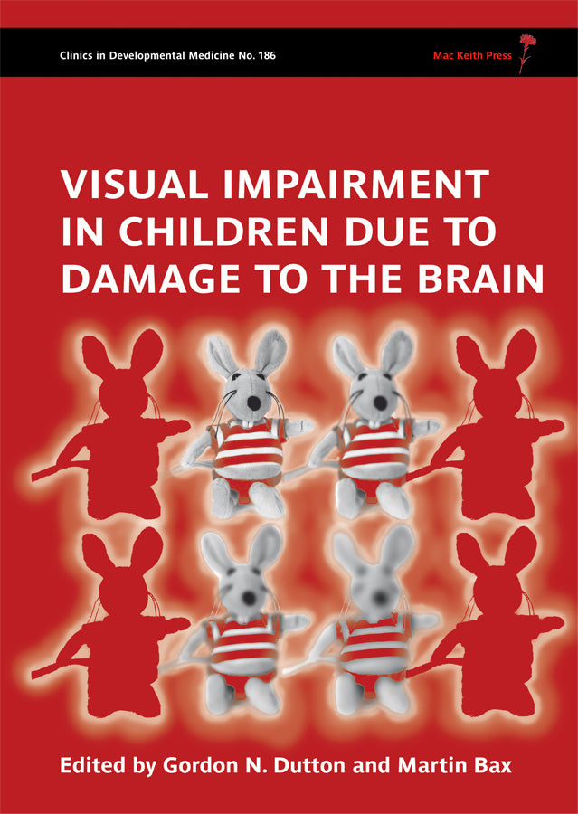 Visual Impairment in Children due to Damage to the Brain (Hardback) 9781898683865