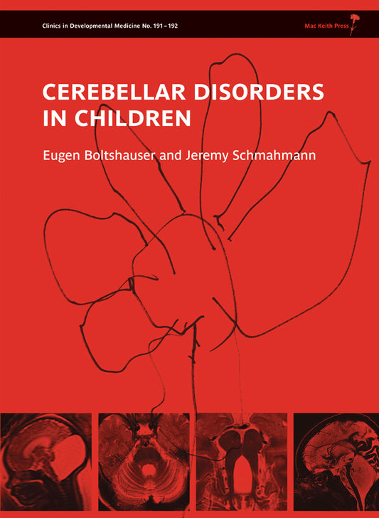 Cerebellar Disorders in Children (Hardback) 9781907655012