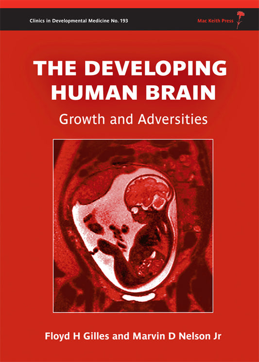 The Developing Human Brain; Growth and Adversities (Hardback) 9781908316417