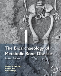 The Bioarchaeology of Metabolic Bone Disease (Paperback / softback) 9780081010204
