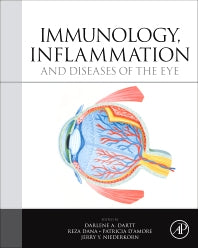 Immunology, Inflammation and Diseases of the Eye (Paperback / softback) 9780081016596