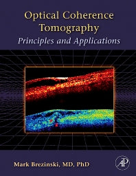 Optical Coherence Tomography; Principles and Applications (Hardback) 9780121335700