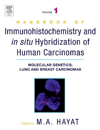 Handbook of Immunohistochemistry and in Situ Hybridization of Human Carcinomas; Molecular Genetics; Lung and Breast Carcinomas (Hardback) 9780123339416