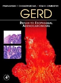 GERD; Reflux to Esophageal Adenocarcinoma (Hardback) 9780123694164