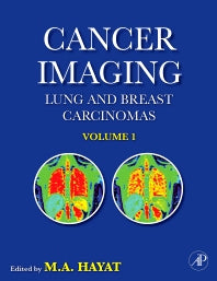 Cancer Imaging; Lung and Breast Carcinomas (Hardback) 9780123704689