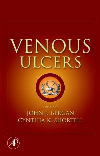 Venous Ulcers (Hardback) 9780123735652