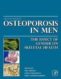 Osteoporosis in Men; The Effects of Gender on Skeletal Health (Hardback) 9780123746023