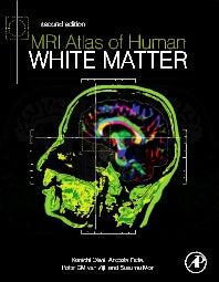 MRI Atlas of Human White Matter (Hardback) 9780123820815