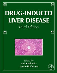 Drug-Induced Liver Disease (Hardback) 9780123878175