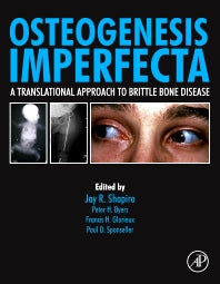 Osteogenesis Imperfecta; A Translational Approach to Brittle Bone Disease (Hardback) 9780123971654