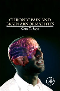 Chronic Pain and Brain Abnormalities (Hardback) 9780123983893