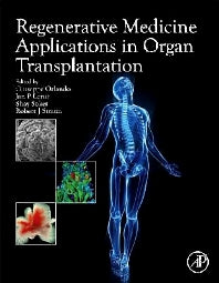 Regenerative Medicine Applications in Organ Transplantation (Hardback) 9780123985231