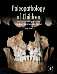 Paleopathology of Children; Identification of Pathological Conditions in the Human Skeletal Remains of Non-Adults (Hardback) 9780124104020