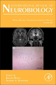 Metal Related Neurodegenerative Disease (Hardback) 9780124105027