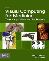 Visual Computing for Medicine; Theory, Algorithms, and Applications (Hardback) 9780124158733