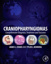 Craniopharyngiomas; Comprehensive Diagnosis, Treatment and Outcome (Hardback) 9780124167063