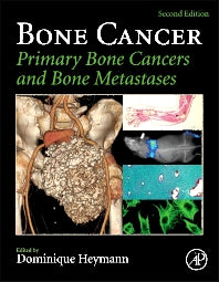 Bone Cancer; Primary Bone Cancers and Bone Metastases (Hardback) 9780124167216