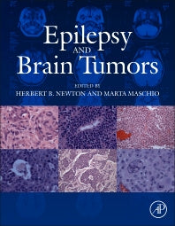 Epilepsy and Brain Tumors (Hardback) 9780124170438