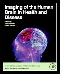 Imaging of the Human Brain in Health and Disease (Hardback) 9780124186774