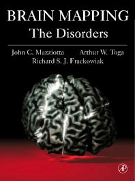 Brain Mapping: The Disorders; The Disorders (Hardback) 9780124814608