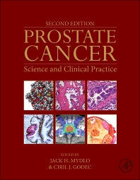 Prostate Cancer; Science and Clinical Practice (Hardback) 9780128000779