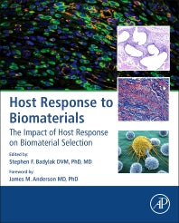 Host Response to Biomaterials; The Impact of Host Response on Biomaterial Selection (Hardback) 9780128001967