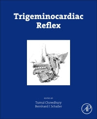 Trigeminocardiac Reflex (Hardback) 9780128004210