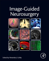 Image-Guided Neurosurgery (Hardback) 9780128008706