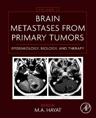 Brain Metastases from Primary Tumors Volume 1; Epidemiology, Biology, and Therapy (Hardback) 9780128008966