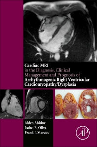 Cardiac MRI in Diagnosis, Clinical Management, and Prognosis of Arrhythmogenic Right Ventricular Cardiomyopathy/Dysplasia (Paperback) 9780128012833