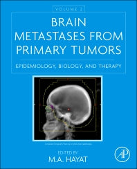 Brain Metastases from Primary Tumors, Volume 2; Epidemiology, Biology, and Therapy (Hardback) 9780128014196