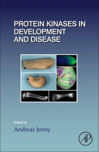 Protein Kinases in Development and Disease (Hardback) 9780128015131