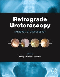 Retrograde Ureteroscopy; Handbook of Endourology (Hardback) 9780128024034