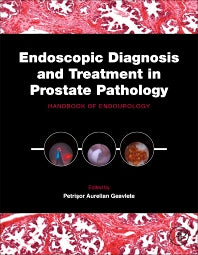 Endoscopic Diagnosis and Treatment in Prostate Pathology; Handbook of Endourology (Hardback) 9780128024058