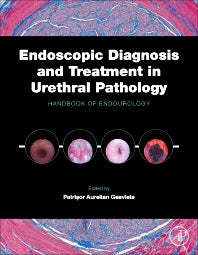 Endoscopic Diagnosis and Treatment in Urethral Pathology; Handbook of Endourology (Hardback) 9780128024065